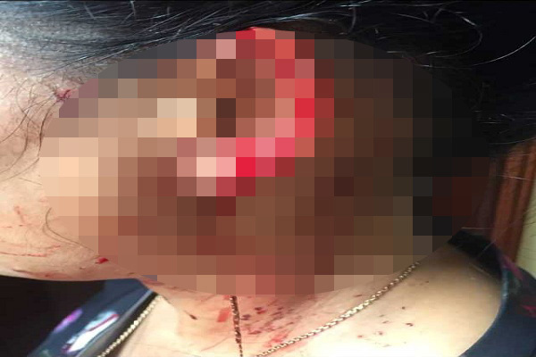 Nữ doanh nhân Quảng Bình tố bị súng bắn ngay giữa phố