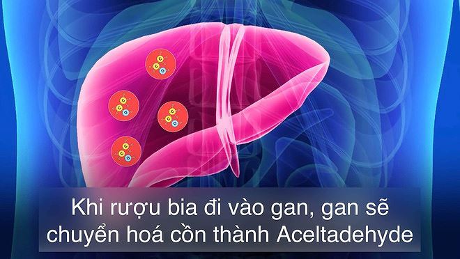 Có nên bán nhà phố 18 tỷ để mua chung cư và đất nền?