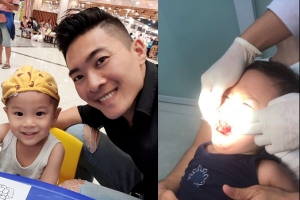 Con trai Quốc Cơ ngã đập miệng vào ghế phải nhập viện