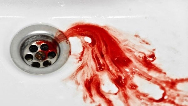 Cô gái trẻ nôn ra 2 lít máu, phải cắt bỏ 60% dạ dày vì ung thư