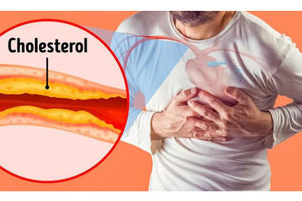 Bí quyết giảm mỡ máu, phòng tai biến từ Nhật Bản