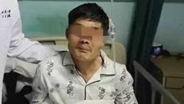 Người đàn ông say rượu nôn ra khối u 10cm, sau đó cố nuốt trở lại