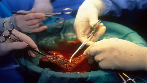 Mẹ ruột hiến 180 gram gan, bé trai 80 ngày tuổi thoát chết thần kỳ