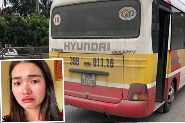 Nữ hành khách bị chủ xe ở Hà Tĩnh đánh chảy máu mũi rút đơn