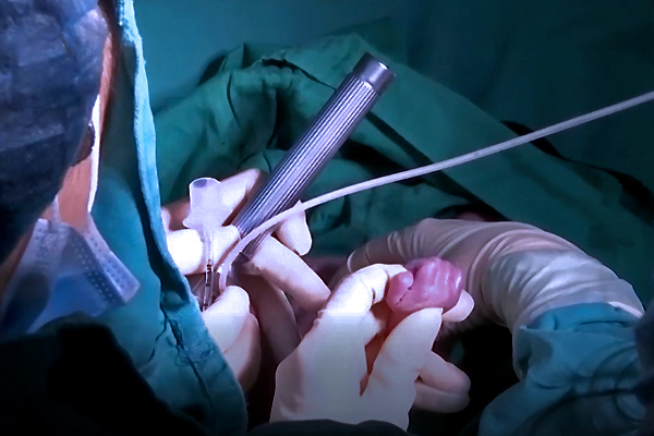 Bé Bình An nắm chặt tay bác sĩ, điều kỳ diệu đến với cả 2 mẹ con