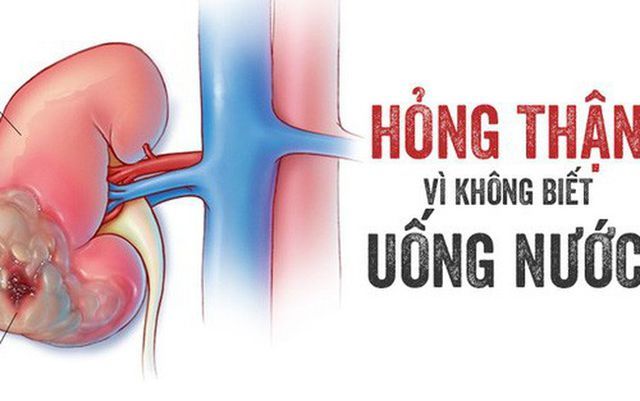 3 thói quen uống nước làm hỏng thận nhiều người mắc