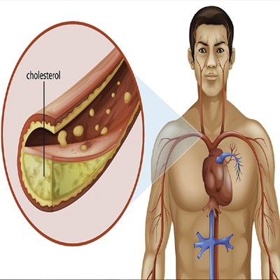 Mô hình lý tưởng và giá phải trả cho việc ra khỏi hang động