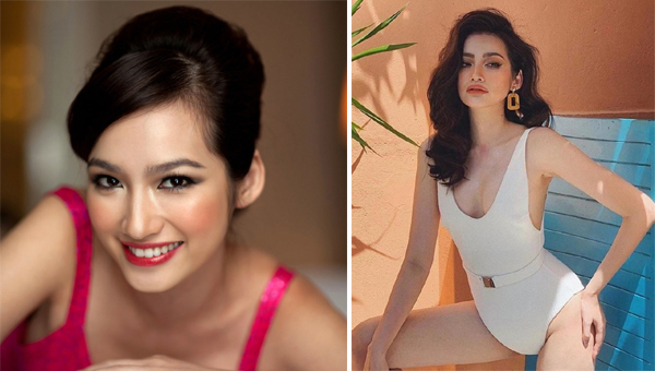 Căn bệnh khiến Hoa hậu Trúc Diễm bị mắt lồi, mặt sưng nguy hiểm như thế nào?