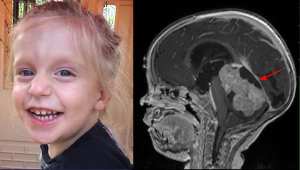 Được chẩn đoán táo bón, bé gái 4 tuổi đột ngột tử vong sau vài tuần