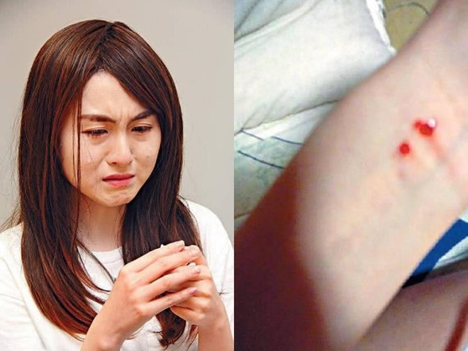 Nữ ca sĩ Hong Kong bị quản lý ép làm nô lệ tình dục suốt 2 năm