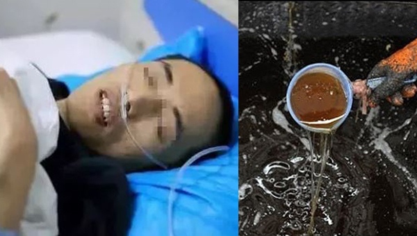 Người đàn ông 36 tuổi chết vì ung thư gan, bác sĩ chỉ lý do bất ngờ