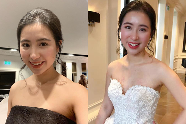 Nữ bác sĩ gốc Việt mồ côi mẹ lúc 10 tuổi vào top 10 hoa hậu Úc