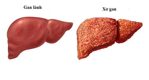 Dự báo bất ngờ về vàng sau tuần tăng giá mạnh