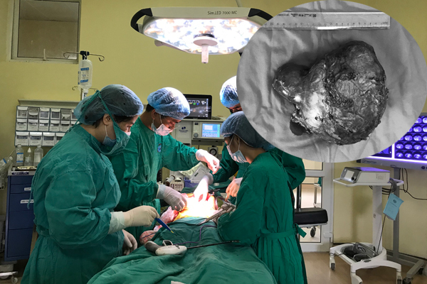 Thận bé gái 6 tuổi ‘mọc’ ra khối u to bằng 2 quả bưởi