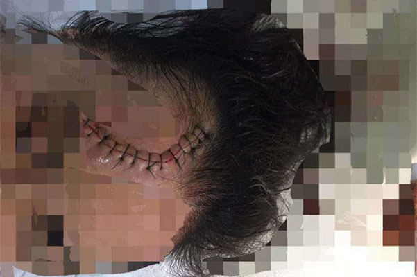 Truy tìm ô tô CX5 tông trọng thương cô gái rồi bỏ chạy ở Hà Nội