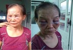 Con dâu đánh mẹ chồng ở Bình Phước bị phạt 2 triệu, tiết lộ thêm câu chuyện