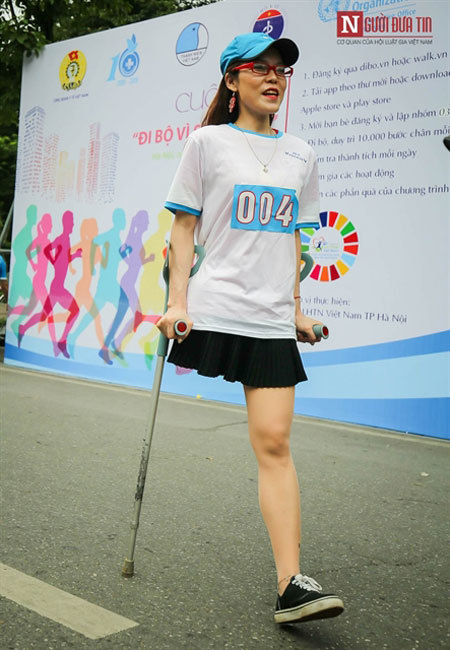 Incredible woman loses and finds a leg to stand on