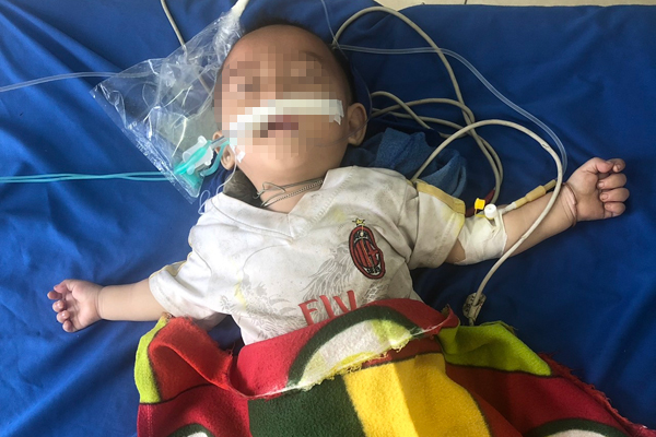 Bé trai 1 tuổi tím tái, ngừng thở vì ngộ độc thuốc phiện