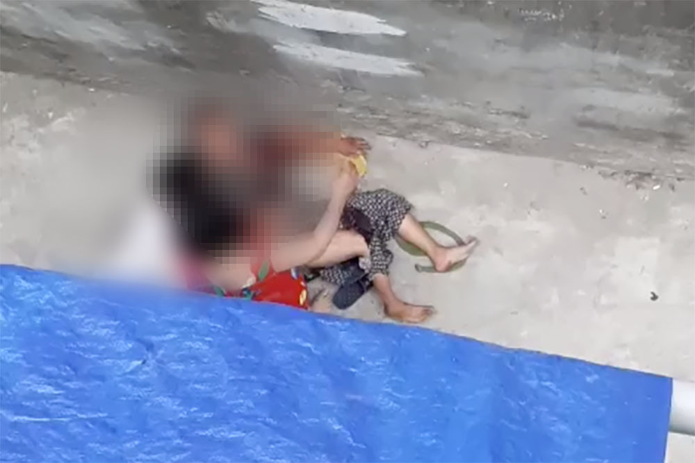 Cụ bà 77 ở Hà Nội bị chó nhà cháu ngoại cắn điên cuồng