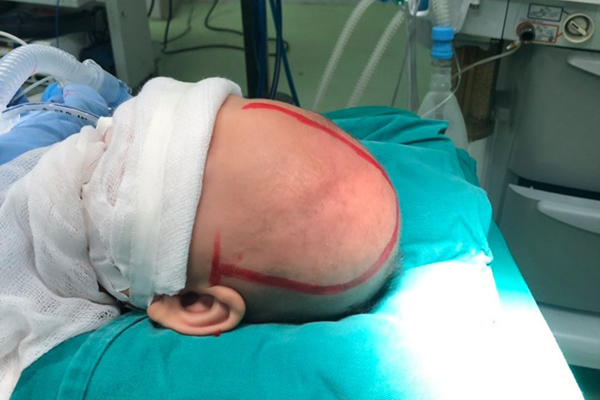 Bé trai Phú Thọ người lớn nhưng đầu nhỏ mãi