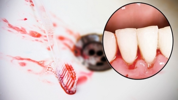 4 tín hiệu này xuất hiện trên mặt, báo hiệu ung thư gan cận kề