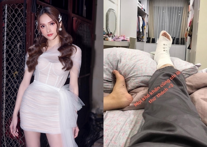 Hương Giang khiến fan lo lắng với hình ảnh chân bó bột