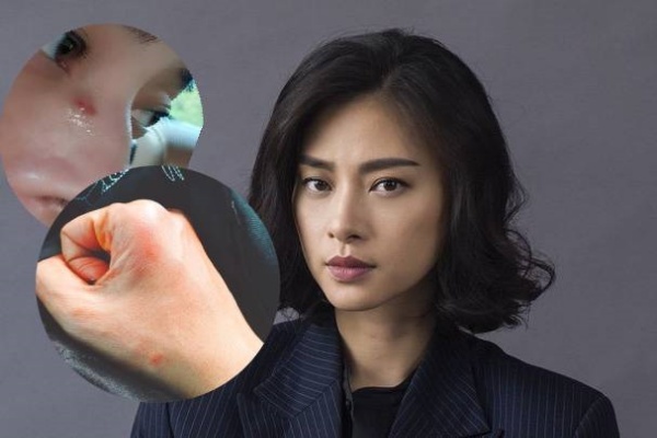 Ngô Thanh Vân bầm dập, chấn thương khi đóng phim ở nước ngoài