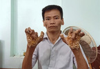 First 'tree man' in Vietnam