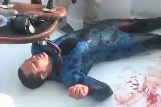 Bị cá mập cắn nham nhở, người đàn ông thoát chết kỳ diệu