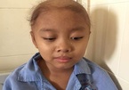 Nước mắt và đau đớn của bé gái 10 tuổi mắc bệnh u não
