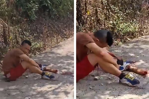 Bị xe cán đứt lìa tay vẫn bình tĩnh ngồi chờ người đến cứu