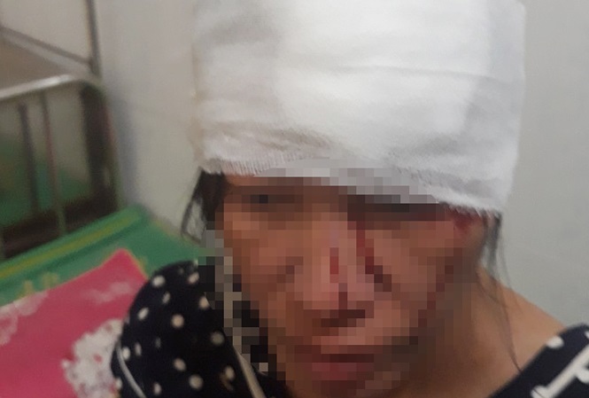 Thai phụ câm điếc ở Thanh Hóa bị hàng xóm đánh nhập viện