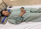 Cô gái 18 tuổi nhập viện cấp cứu do hít bóng cười