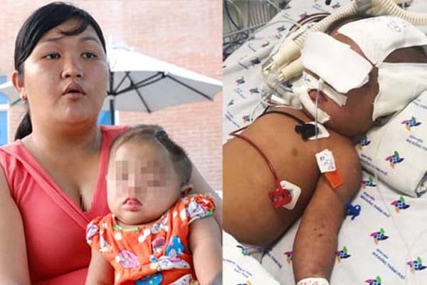 Mẹ của bé gái 8 tháng tuổi nghi bị xuất huyết não ngay ngày đầu tiên gửi nhà trẻ: Cô giáo nói bé tự bị còn camera thì hỏng?