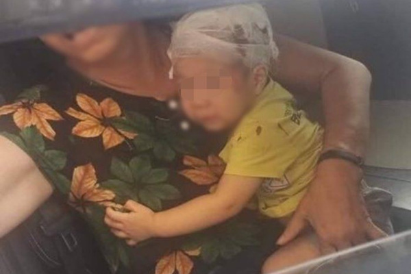 Chổi lau nhà rơi từ tầng 17 trúng đầu bé trai hơn 1 tuổi ở Hà Nội