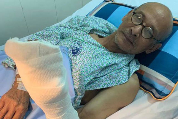 Nhà văn Nguyễn Văn Thọ phải cấp cứu vì cưa điện cắt đứt nửa bàn tay