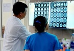 Việt Nam lần đầu ghi nhận xuất huyết não do ma túy đá ở người trẻ