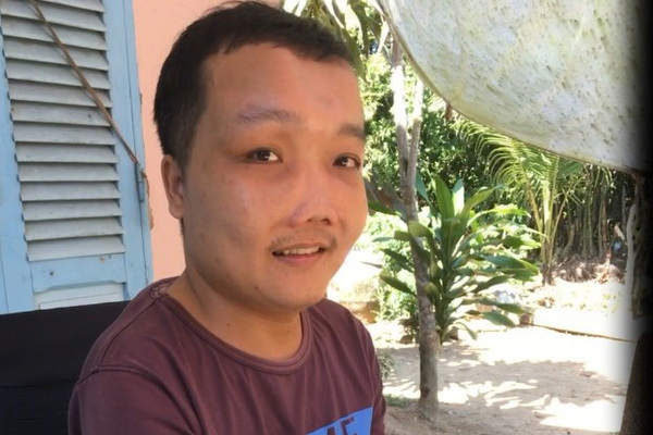 Chuyện tình buồn của chàng trai xương thủy tinh ở Tiền Giang