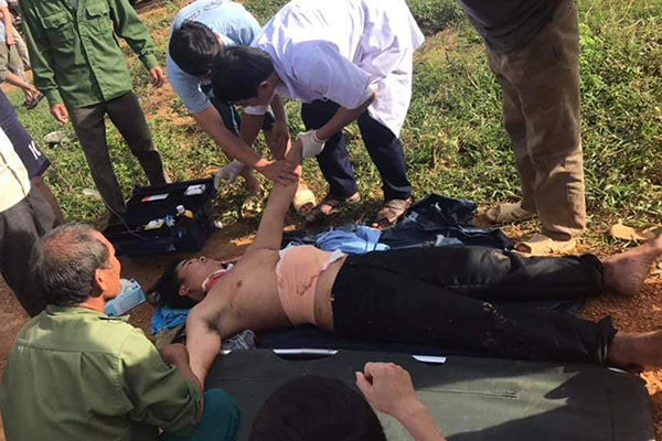 Người đàn ông Nghệ An tự rạch bụng vì nghĩ bên trong có bom