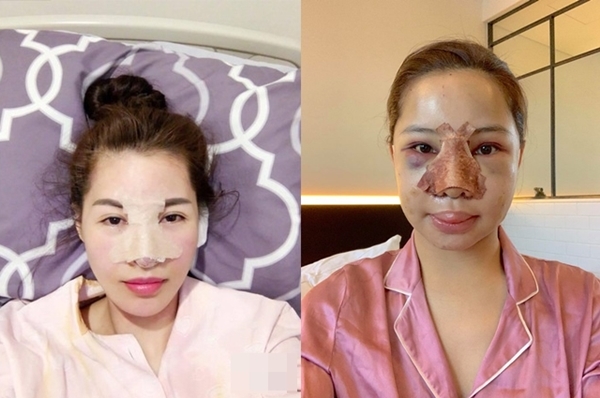 Những sao Việt gây choáng khi công bố hình ảnh 'đập mặt xây lại'