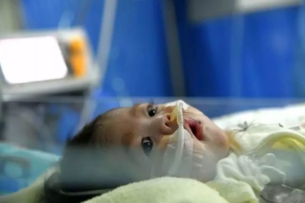 Bé gái 2 tháng tuổi sống tiếp nhờ trái tim được tặng lấy đi nước mắt triệu người
