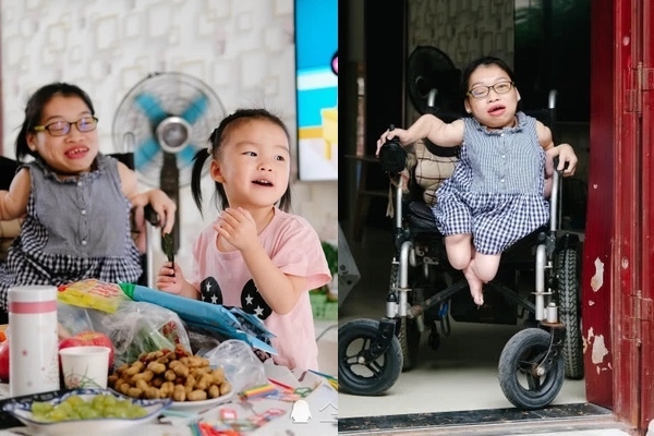 Bà mẹ 'búp bê sứ' cao 89cm mạo hiểm sinh con