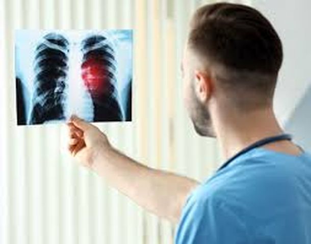 4 biểu hiện khi ngủ cho thấy phổi của bạn đã bị tổn thương - Ảnh 1.