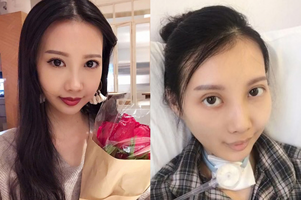 Nữ ca sĩ Hong Kong sống lạc quan dù mắc ung thư giai đoạn cuối