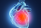 Inequalities in heart attack care 'costing women's lives'