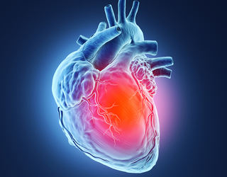 Inequalities in heart attack care 'costing women's lives'