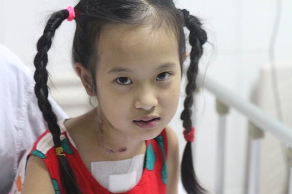 Bố mẹ ly dị, bé gái 9 tuổi bị tim bẩm sinh phải mổ hai lần mới giữ được mạng sống