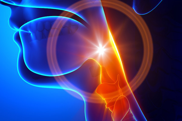 Những dấu hiệu dễ nhầm lẫn của ung thư vòm họng