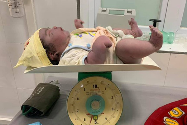 Nghe VietNamNet: Bé gái sơ sinh nặng 5,5kg chào đời bằng phương pháp sinh thường