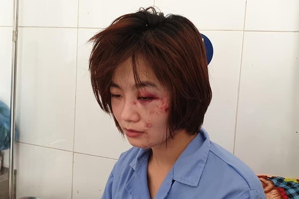 Khởi tố, truy bắt nhóm thanh niên đánh nữ nhân viên xe buýt ở Hà Nội